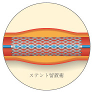 Xegup